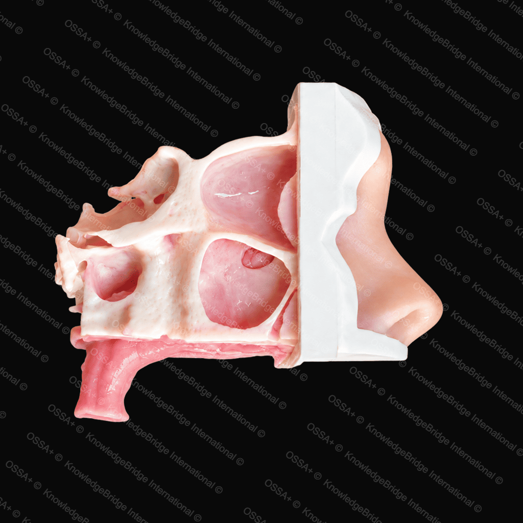 Frontal Balloon Sinuplasty Trainer view 2