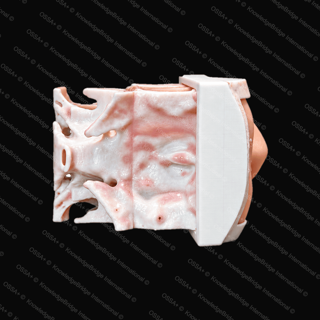 Frontal Balloon Sinuplasty Trainer view 3