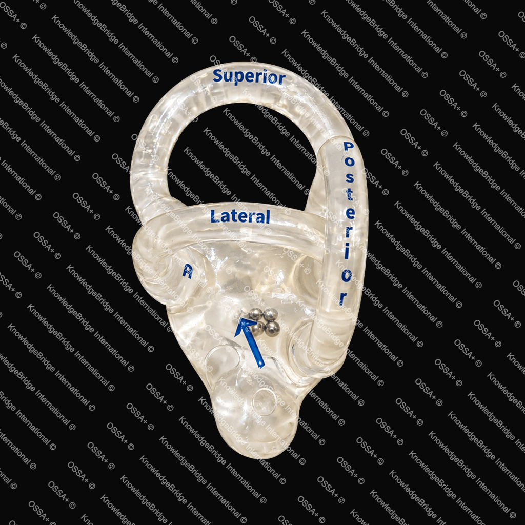 Labyrinth Model for the Epley Maneuver view 1