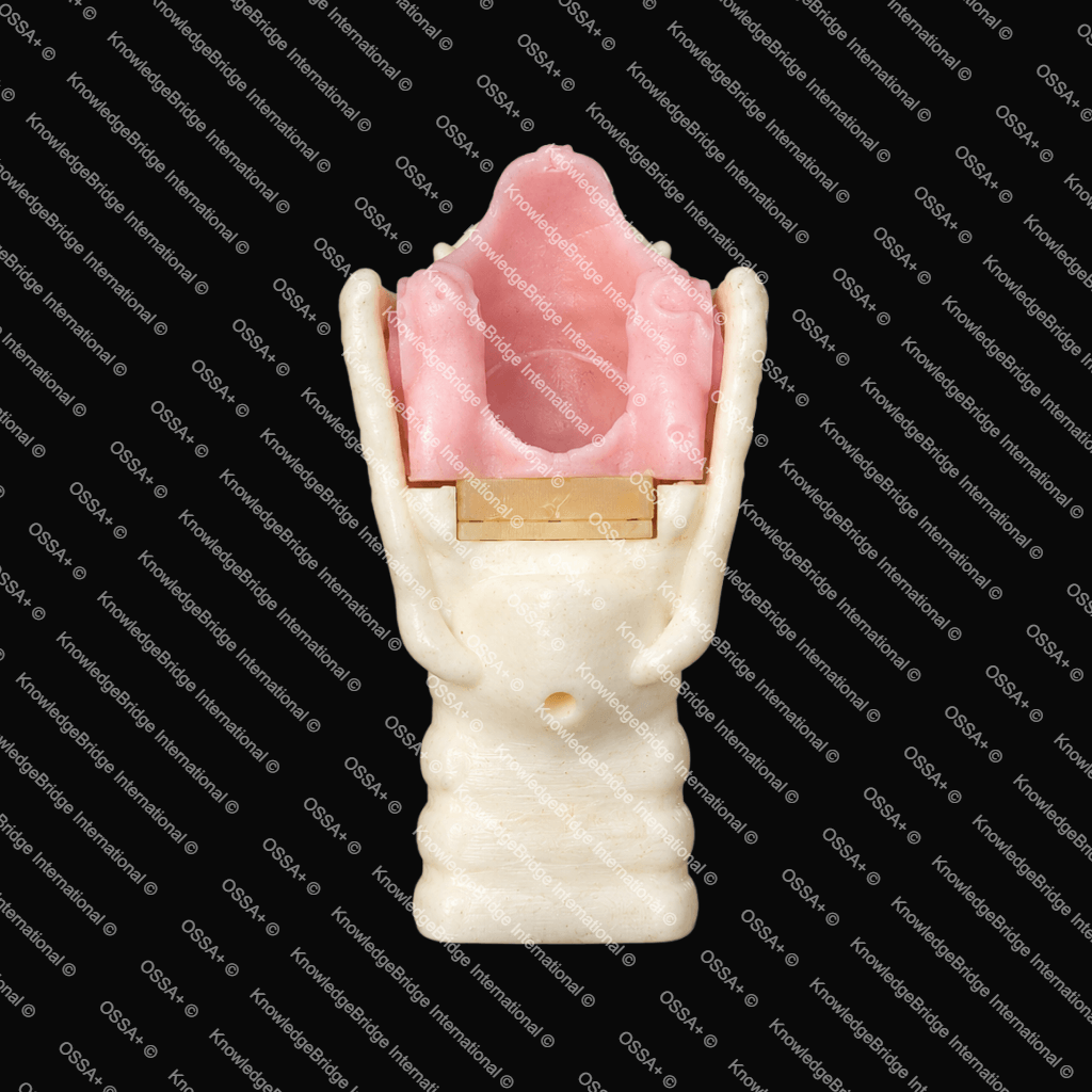 Artificial Larynx Model view 1