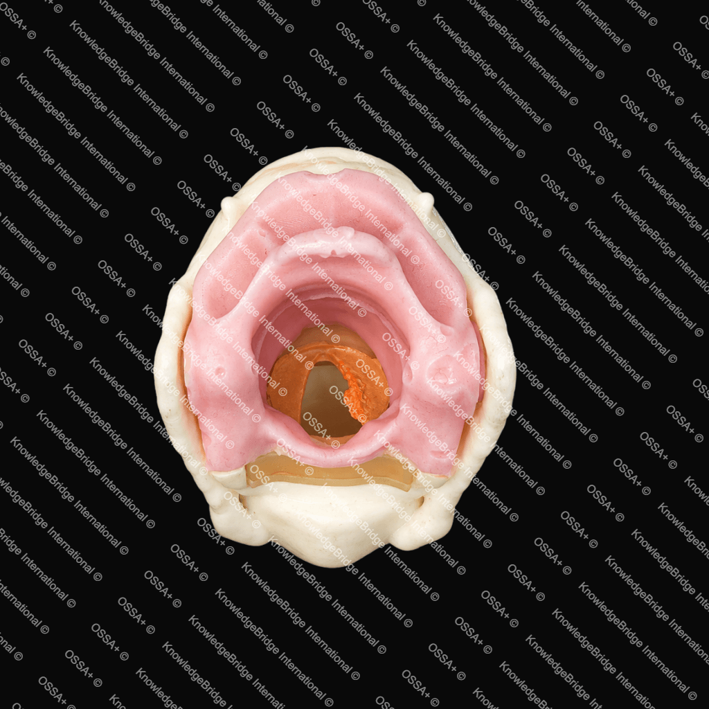 Artificial Larynx Model view 3